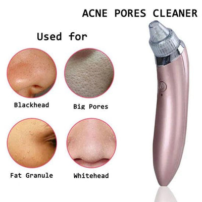 Face Vacuum Blackhead Remover Pore Cleaner Review by Reem Al Falasi