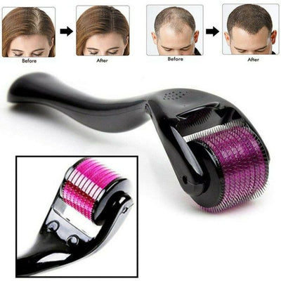 Skin Therapy Derma Roller With 540 Micro Needle Review by Sara Al Marzooqi