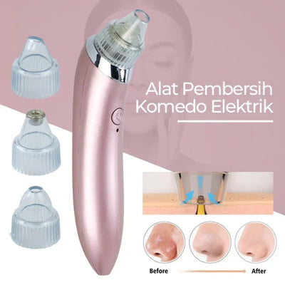 Face Vacuum Blackhead Remover Pore Cleaner Review by Rashid Al Nuaimi